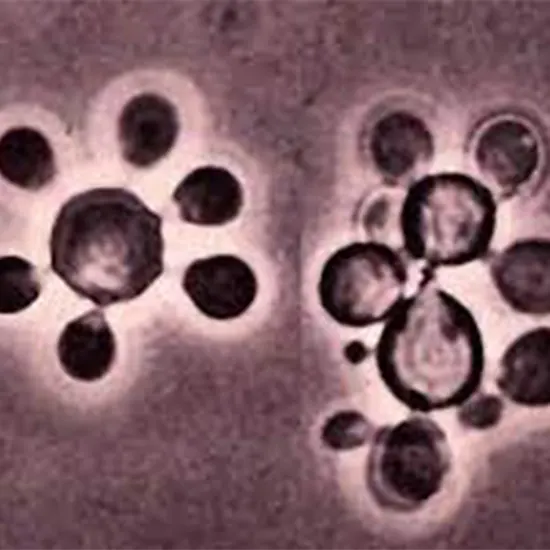 paracoccidioidomycosis package